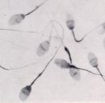 sperm.jpg